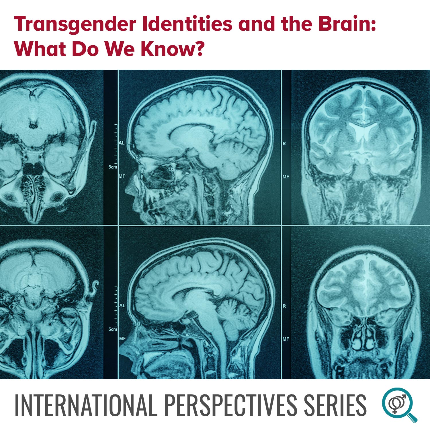 Transgender Identities and the Brain: What Do We Know?  Banner